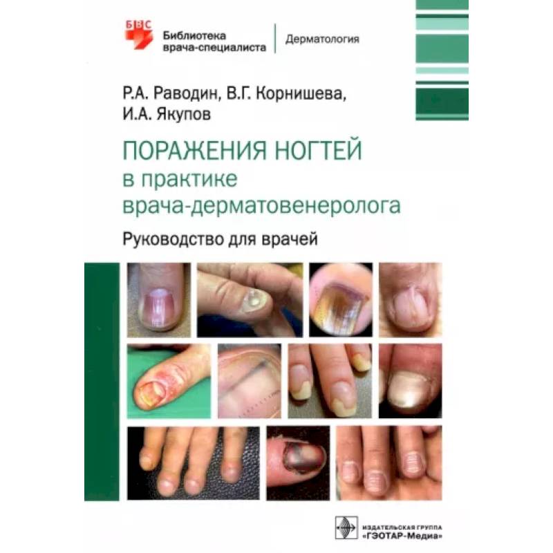 Поражения ногтей в практике врача-дерматовенеролога. Руководство для врачей Поражения ногтей в практике врача-дерматовенеролога. Руководство для врачей