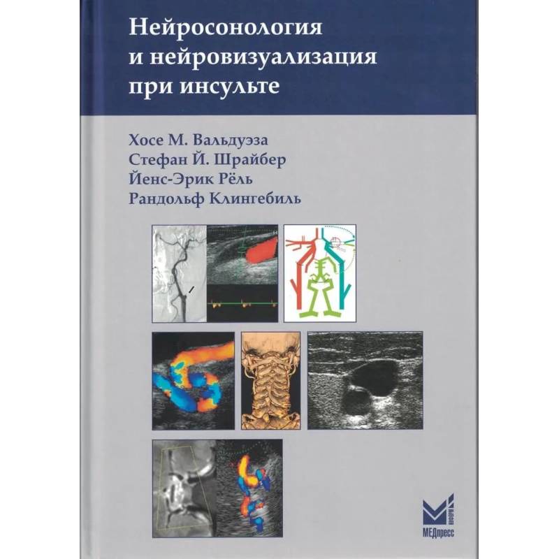 Нейросонология и нейровизуализация при инсульте Нейросонология и нейровизуализация при инсульте