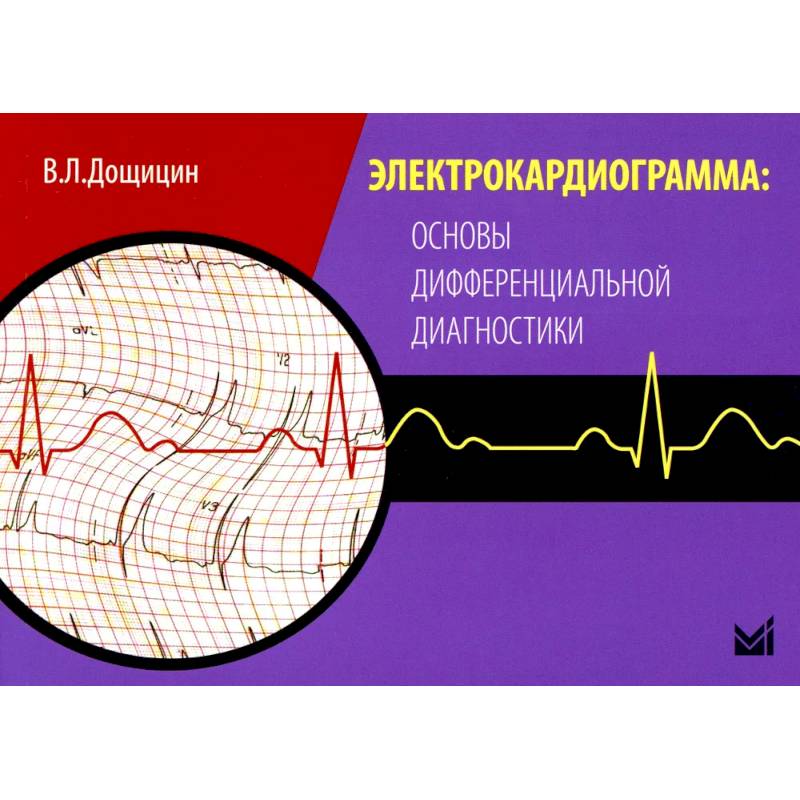 Электрокардиограмма: основы дифференциальной диагностики. 2-е издание Электрокардиограмма: основы дифференциальной диагностики. 2-е издание