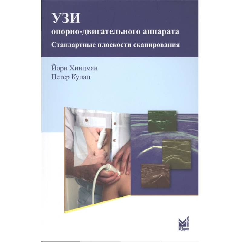 УЗИ опорно-двигательного аппарата УЗИ опорно-двигательного аппарата