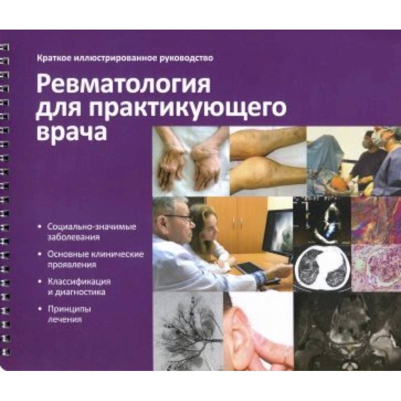 Краткое иллюстрированное руководство «Ревматология для практикующего врача» Краткое иллюстрированное руководство «Ревматология для практикующего врача»