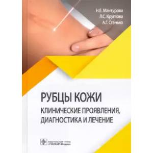 Рубцы кожи. Клинические проявления,диагностика и лечение Рубцы кожи. Клинические проявления,диагностика и лечение