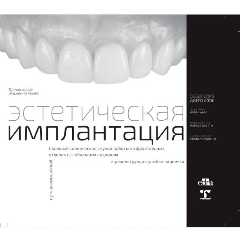 Эстетическая имплантация Эстетическая имплантация