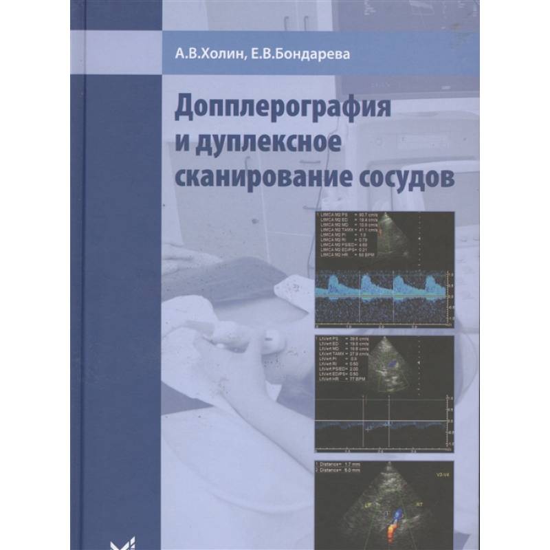 Допплерография и дуплексное сканирование сосудов. Холин Допплерография и дуплексное сканирование сосудов. Холин