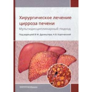 Хирургическое лечение цирроза печени. Мультидисциплинарный подход. Монография Хирургическое лечение цирроза печени. Мультидисциплинарный подход. Монография