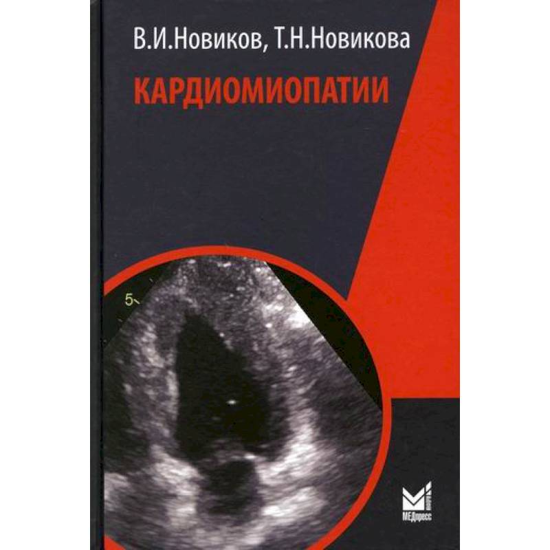 Кардиомиопатии Кардиомиопатии