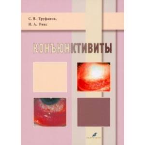 Коньюктивиты. Учебное пособие Коньюктивиты. Учебное пособие