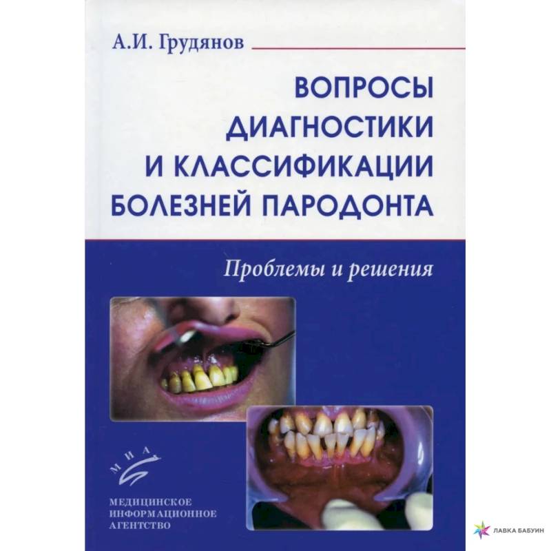 Вопросы диагностики и классификации болезней пародонта. Проблемы и решения Вопросы диагностики и классификации болезней пародонта. Проблемы и решения