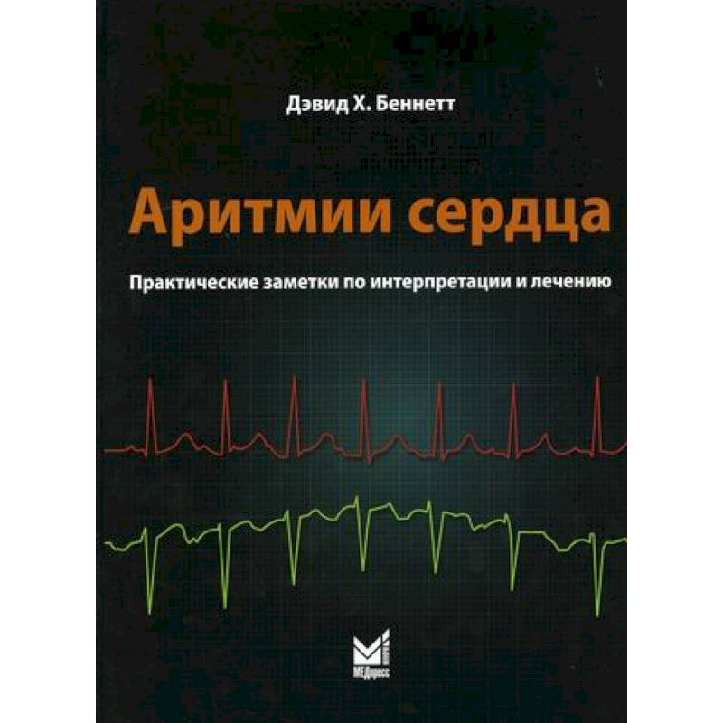 Аритмии сердца Аритмии сердца