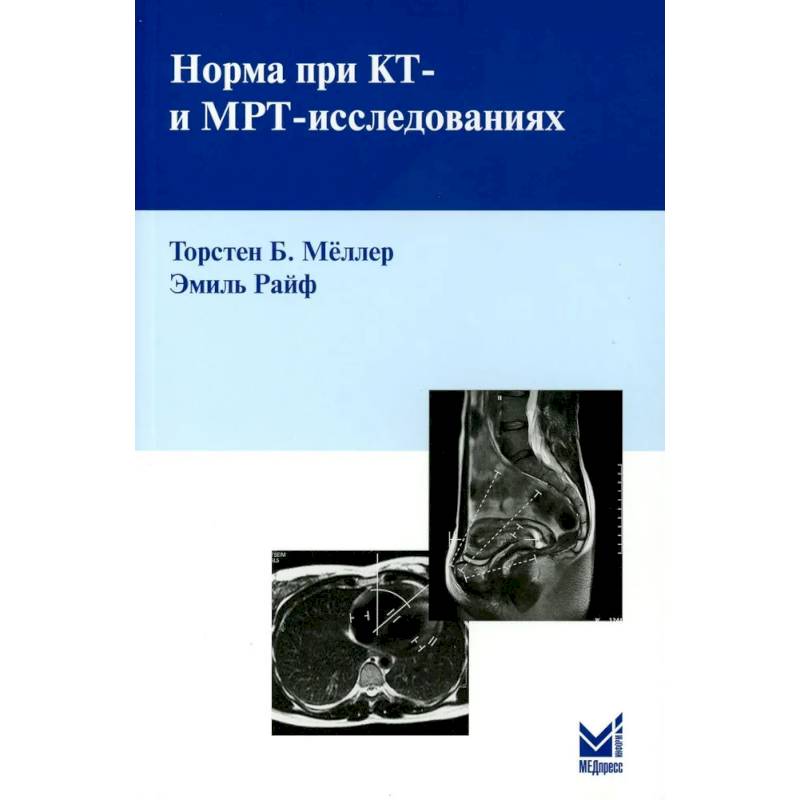 Норма при КТ- и МРТ-исследованиях Норма при КТ- и МРТ-исследованиях