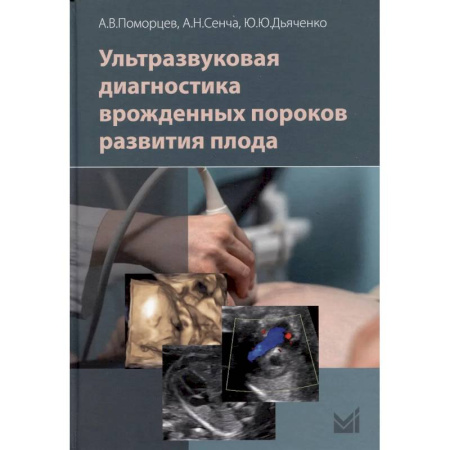 Диагностика. Методы и виды, книга Ультразвуковая диагностика врожденных пороков развития плода