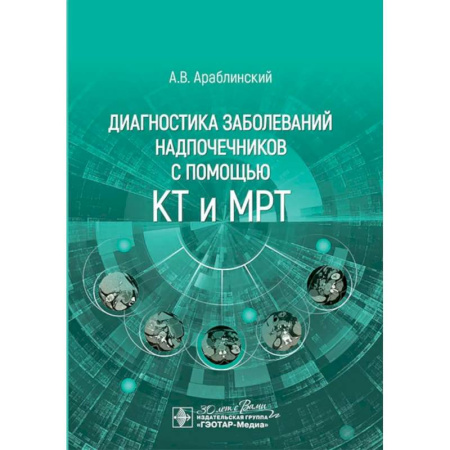 Диагностика. Методы и виды, книга Диагностика заболеваний надпочечников с помощью КТ и МРТ