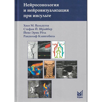 Нейросонология и нейровизуализация при инсульте Нейросонология и нейровизуализация при инсульте