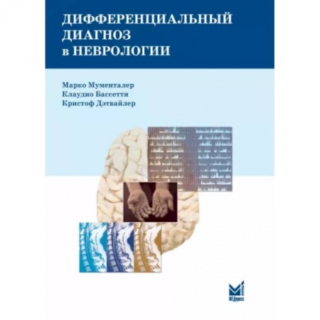 Специальная медицина, книга Дифференциальный диагноз в неврологии. Руководство по оценке, классификации и дифференциональной диагностике неврологических симптомов