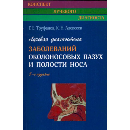 Медицинские энциклопедии и справочники, книга Лучевая диагностика заболеваний околоносовых пазух и полости носа.