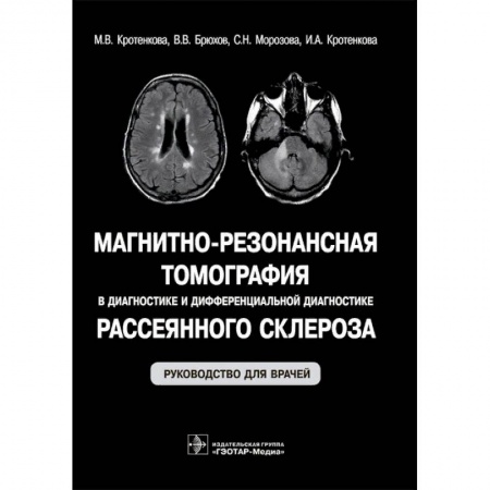 Диагностика. Методы и виды, книга Магнитно-резонансная томография в диагностике и дифференциальной диагностике рассеянного склероза