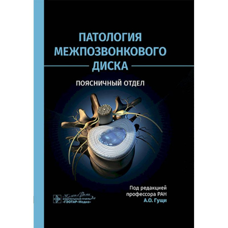 Здоровье, медицинская литература, книга Патология межпозвонкового диска. Поясничный отдел