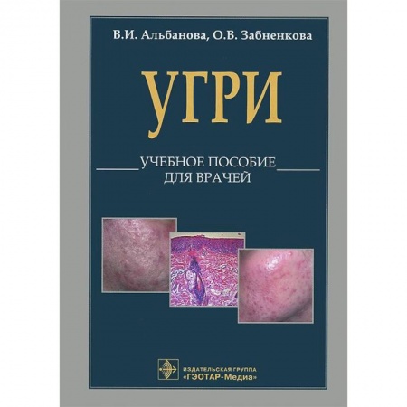 Книги, книга L70. Угри. Учебное пособие для врачей