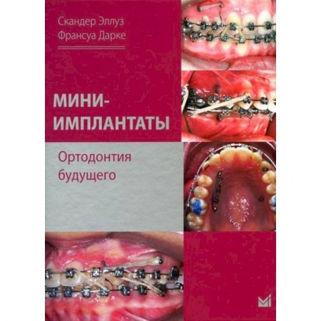 Специальная медицина, книга Мини-имплантаты. Ортодонтия будущего