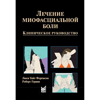 Лечение миофасциальной боли Лечение миофасциальной боли