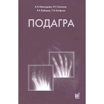 Подагра Подагра
