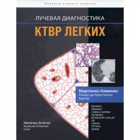 Книги, книга Лучевая диагностика. КТВР легких