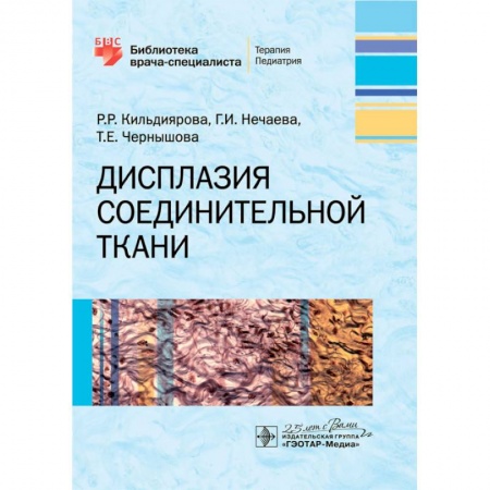 Студентам и аспирантам, книга Дисплазия соединительной ткани