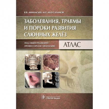 Книги, книга Заболевания, травмы и пороки развития слюнных желез: атлас