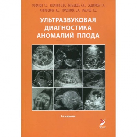 Специальная медицина, книга Ультразвуковая диагностика аномалий плода: Руководство для врачей