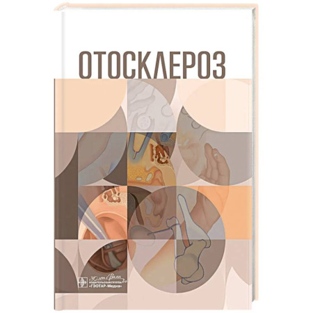 книга Отосклероз с доставкой по Франции Медико-биологические дисциплины, книга Отосклероз