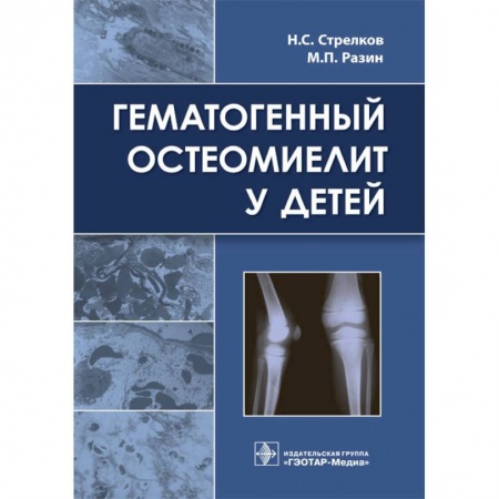 Студентам и аспирантам, книга Гематогенный остеомиелит у детей