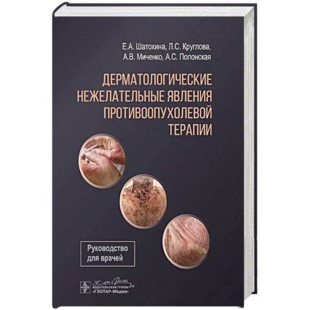 Неотложная помощь. Терапии, книга Дерматологические явления противоопухолевой терапии