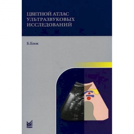 Диагностика. Методы и виды, книга Цветной атлас ультразвуковых исследований