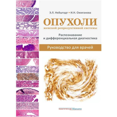 Здоровье, медицинская литература, книга Опухоли женской репродуктивной системы. Распознавание и дифференциальная диагностика. Руководство для врачей