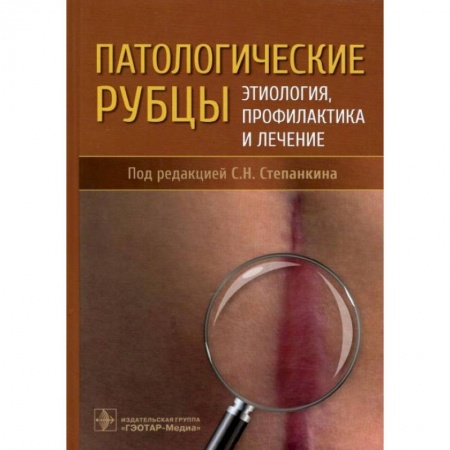 Специальная медицина, книга Патологические рубцы. Этиология, профилактика и лечение