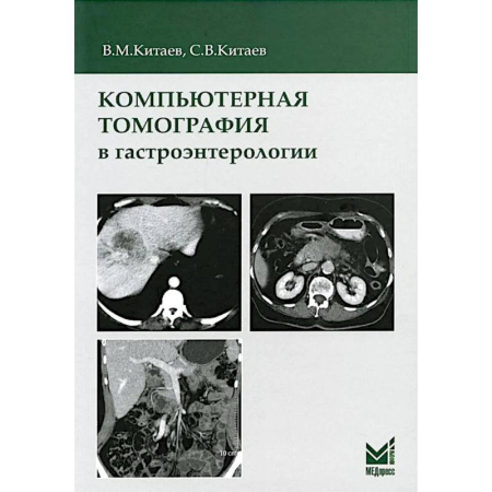 Диагностика. Методы и виды, книга Компьютерная томография в гастроэнтерологии: руководство для врачей.