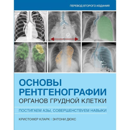 Специальная медицина, книга Основы рентгенографии органов грудной клетки