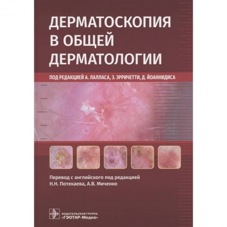 Специальная медицина, книга Дерматоскопия в общей дерматологии