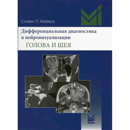 Специальная медицина, книга Дифференциальная диагностика в нейровизуализации. Голова и шея