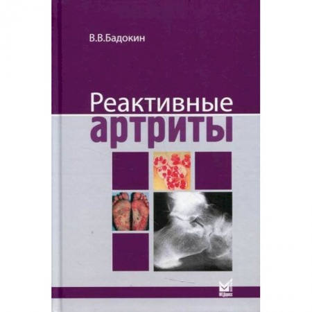 Специальная медицина, книга Реактивные артриты. Урогенитальные и постэнтероколитические