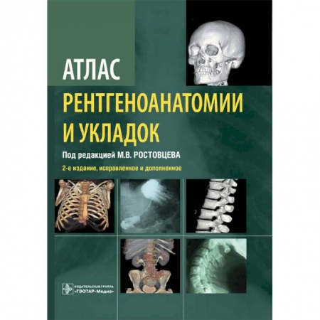 Диагностика. Методы и виды, книга Атлас рентгеноанатомии и укладок.Руководство для врачей