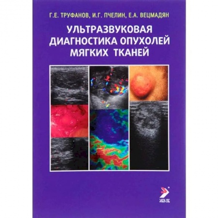 Диагностика. Методы и виды, книга Ультразвуковая диагностика опухолей мягких тканей