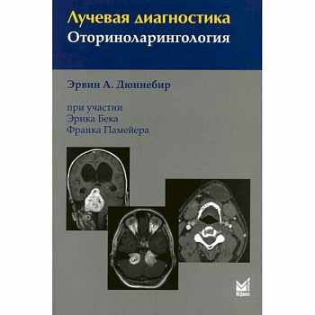 Лучевая диагностика. Оториноларингология Лучевая диагностика. Оториноларингология
