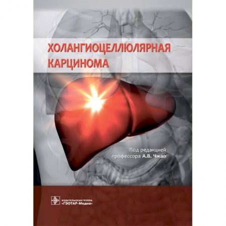 Специальная медицина, книга Холангиоцеллюлярная карцинома