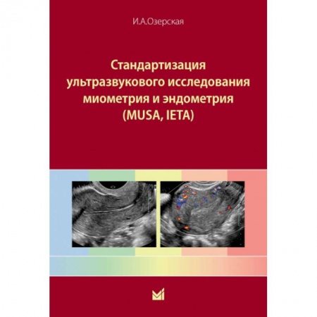 Диагностика. Методы и виды, книга Стандартизация ультразвукового исследования миометрия и эндометрия (MUSA, IETA)