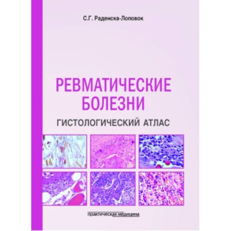 Медицинские энциклопедии и справочники, книга Ревматические болезни. Гистологический атлас