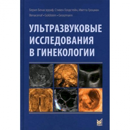 Специальная медицина, книга Ультразвуковые исследования в гинекологии