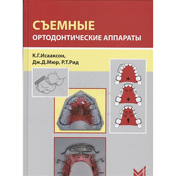 Съемные ортодонтические аппараты Съемные ортодонтические аппараты