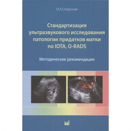 Медико-биологические дисциплины, книга Стандартизация ультразвукового исследования патологии придатков матки по IOTA, O-RADS. Методические рекомендации