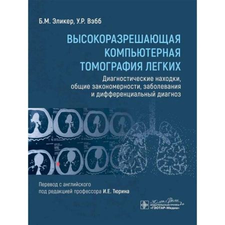 Медицинские энциклопедии и справочники, книга Высокоразрешающая компьютерная томография легких. Диагностические находки, общие закономерности, заболевания и дифференциальный диагноз